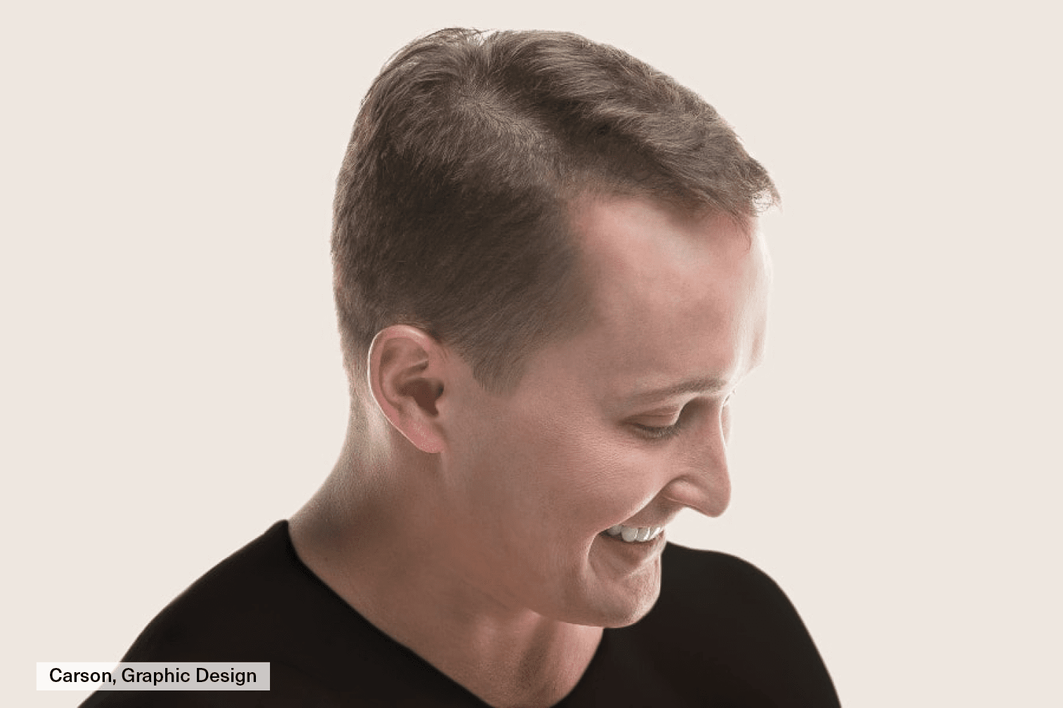 carson hair loss carson hair loss